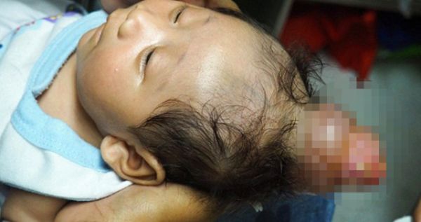 filipinler-de-boynuzlu-bebek-dogdu-10620770_1130_m.jpg