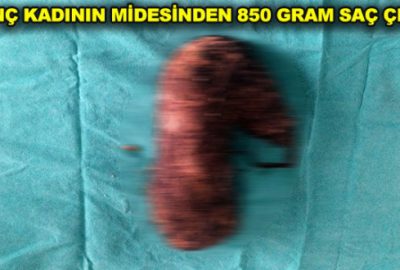 Midesinden çıkana inanamayacaksınız!