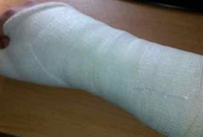 Kırıklara mucize tedavi