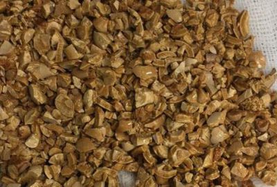 Karabük’te rahatsızlığından dolayı hastaneye giden şahsın mesanesinden 1 kilo taş