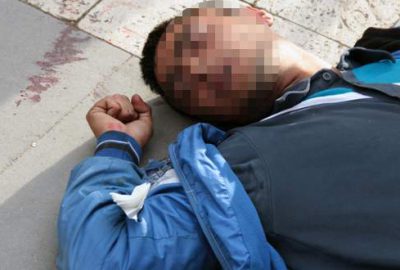 Adana’da bonzai içtiği iddia edilen bir genç, cadde ortasında kesici
