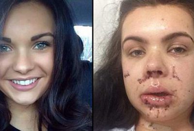 Tanınmayacak hale geldi