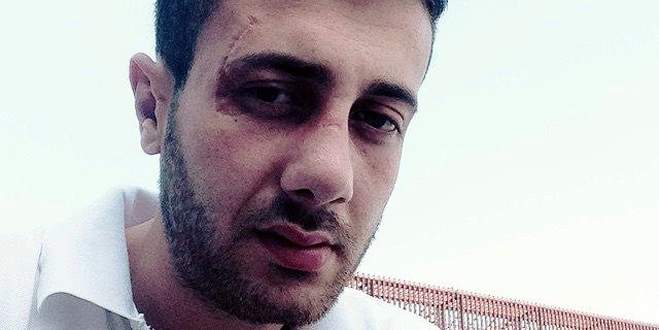 Aşırı hız can aldı