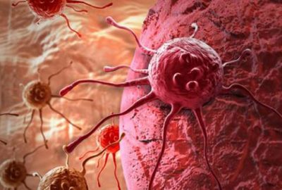 Kanserde sevindiren gelişme