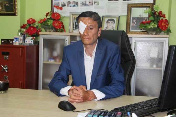 Süer’den Engellilere Sahip Çıkılsın İsteği