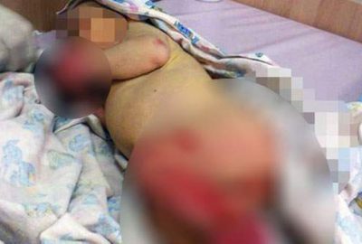 3 günlük bebek ormanda bu halde bulundu!