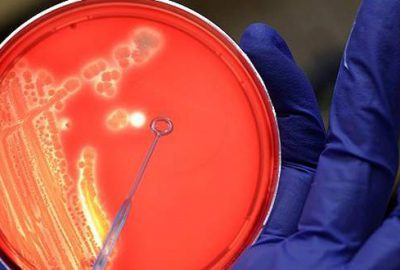 Şarbon krizi büyüyor!