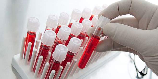 Bir damla kanla, ‘virüs tarihi’ belli olacak