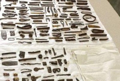 Midesinden bunlar çıktı!