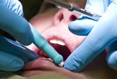 Dişini çektirince öldü