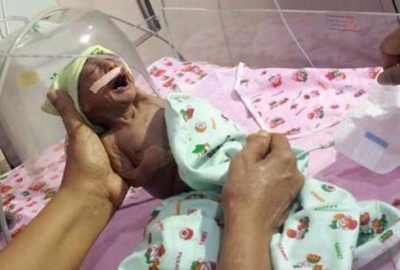 Anne ve babası onu görüntüsü yüzünden terk etti!