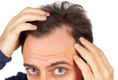 Saç dökülmesine karşı tüketin