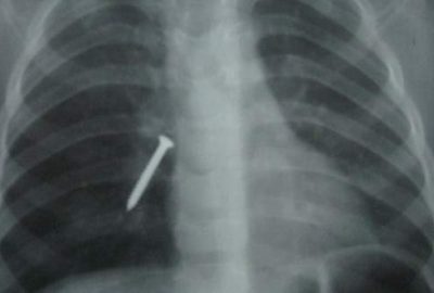 Görenler hayrete düştü