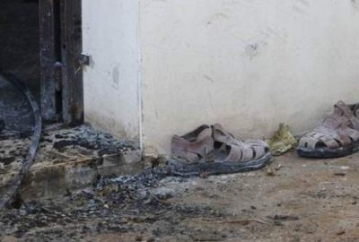 18 aylık bebeği yakarak…