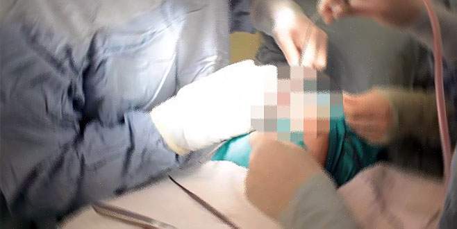 Burnundan iki ceviz büyüklüğünde taş çıktı…