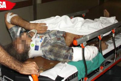 Feci kaza! Asansörün altında kaldılar