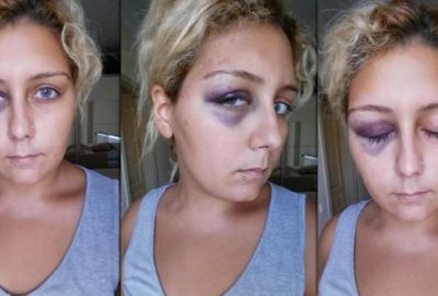 Sevgilisinden gördüğü şiddeti sayfasında duyurdu