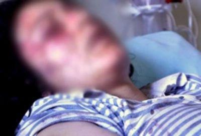 Koca şiddetine dayanamadı, balkondan atladı!