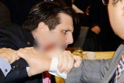 Büyükelçiye usturayla saldırmanın bedeli ağır oldu