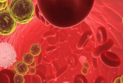 Sinsi hastalık sepsis bilinmiyor