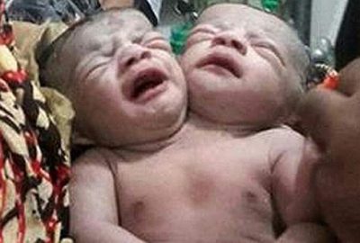 Tek bedende iki bebek