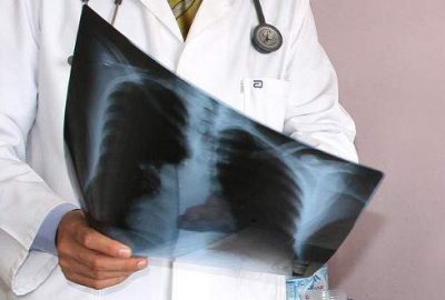 Erciyes Üniversitesi (ERÜ) Tıp Fakültesi Hastanesi Göğüs Hastalıkları Anabilim Dalı