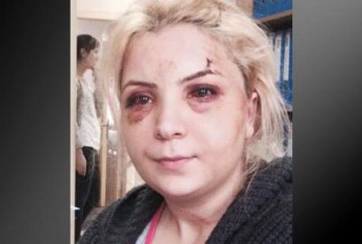 ‘Eski kocam dövdü’ diye karakola gitti, cinayetten tutuklandı