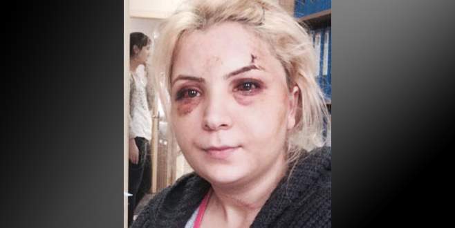 ‘Eski kocam dövdü’ diye karakola gitti, cinayetten tutuklandı