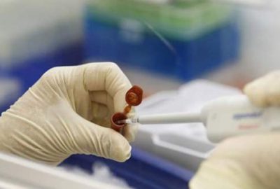 Domuz gribi yayılıyor