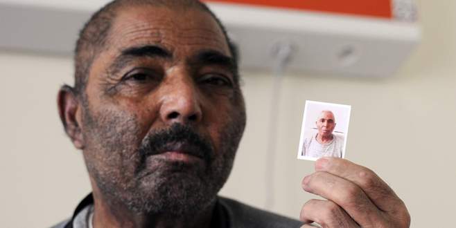 Ak düşen saçları 58’inden sonra siyahlaştı