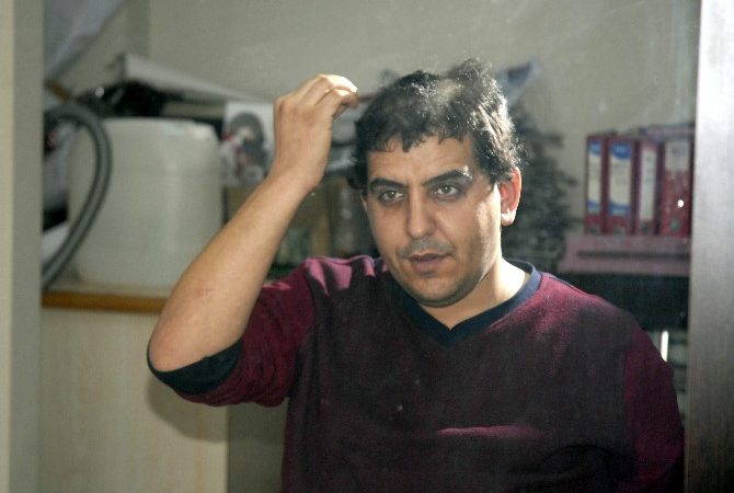 Eskişehir’de bir erkek kuaförü, piyasada satılan saç düzleştirme ilacını sonucunu