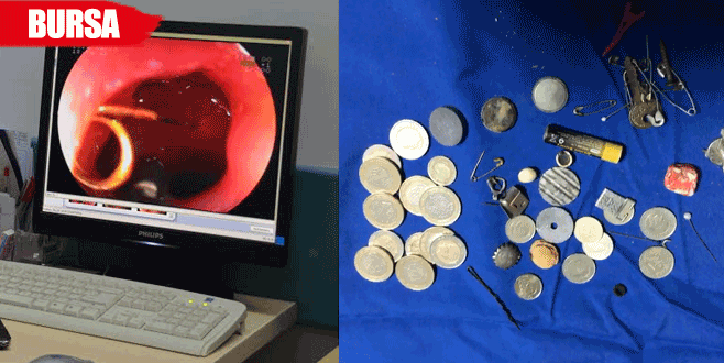 Bunların hepsi çocukların yemek borusundan çıktı