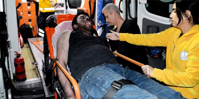 Kendi yaktığı evinde ağır yaralandı