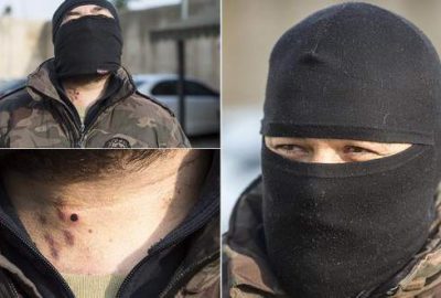 Yaralanan ‘özel harekatçı’ eve dönmeyi kabul etmedi