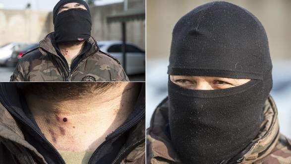 Yaralanan ‘özel harekatçı’ eve dönmeyi kabul etmedi