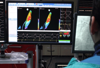Kalpte ritim bozukluğuna dikkat