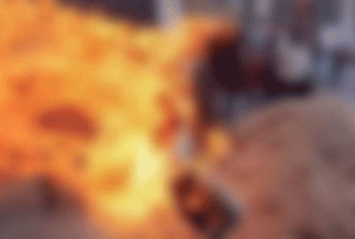 Babası otomobil parasını tamamlamayınca kendini yaktı