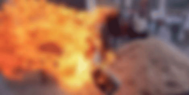 Babası otomobil parasını tamamlamayınca kendini yaktı