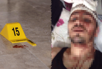 Komşuların silahlı, satırlı kavgası: 1 ölü, 5 yaralı