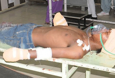 8 aylık bebeğine tecavüz eden gencin ellerini kesti