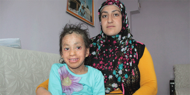 6 yaşındaki Azra tedavi için yardım bekliyor