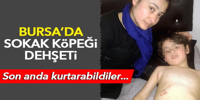 8 yaşındaki Toprak’a sokak köpekleri saldırdı