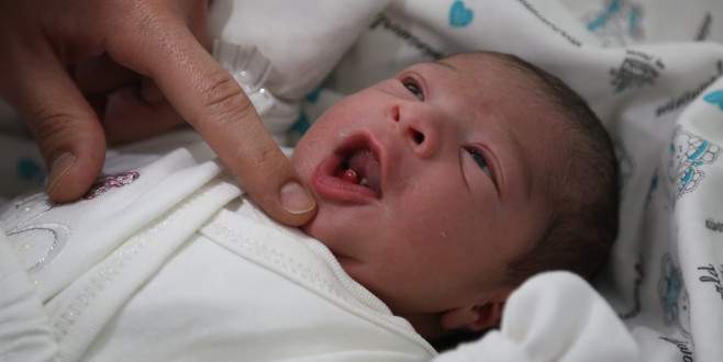 İki dişli doğan bebek şaşırttı