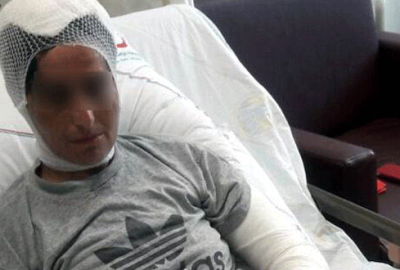 İşkence edilen kadın konuştu!