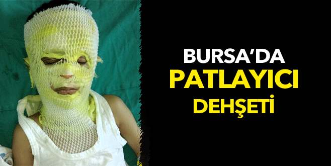 Bursa’da çatapat ve barutlu mantar karışımı bu hale getirdi