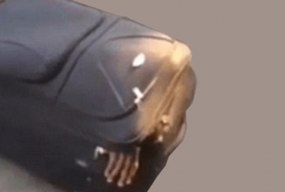 Polis böyle yakaladı! Valizden el çıkınca…