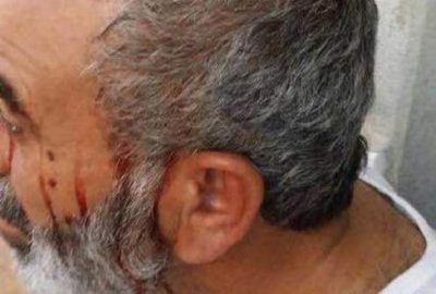 Suriyelileri uyaran baba-oğul bıçaklandı