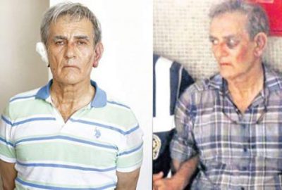 Akın Öztürk’ün yüzündeki 2 gün farkı