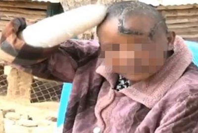 Hamile kalamayan karısının ellerini kesti