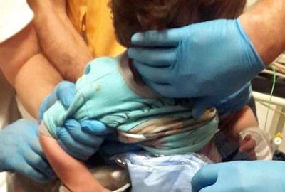 Minik Ahmed elini kıyma makinesine kaptırdı